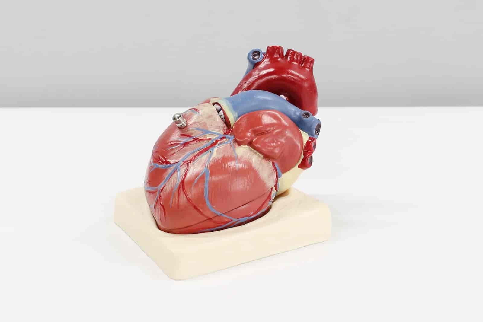 Łuk aorty miażdżycowo wysycony – co to znaczy