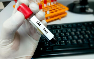 Jak obniżyć zły cholesterol i podnieść dobry?