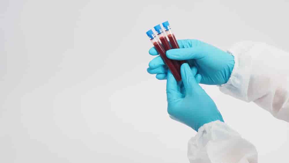 Co to są trójglicerydy w badaniu krwi?